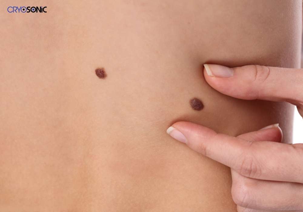 Infection Risk and Poor Aftercare Hartlepool