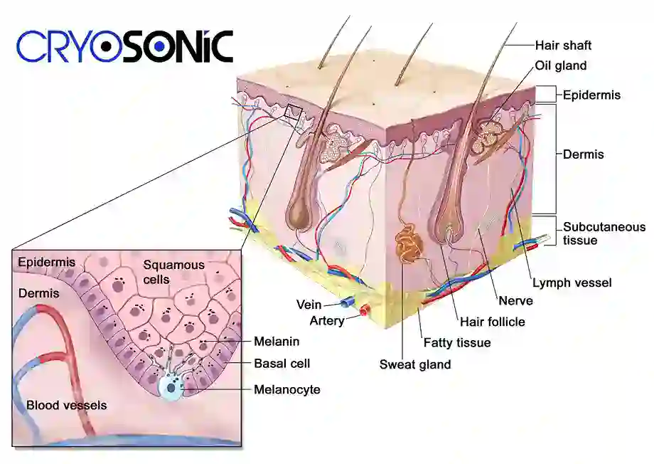 How Cryotherapy Stimulates Melanocyte Activity  Hartlepool